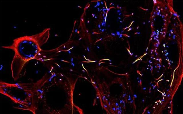 干细胞新技术抗衰老