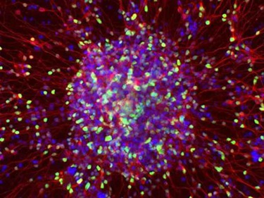 干细胞因子美容是什么-干细胞因子美容管多久和作用