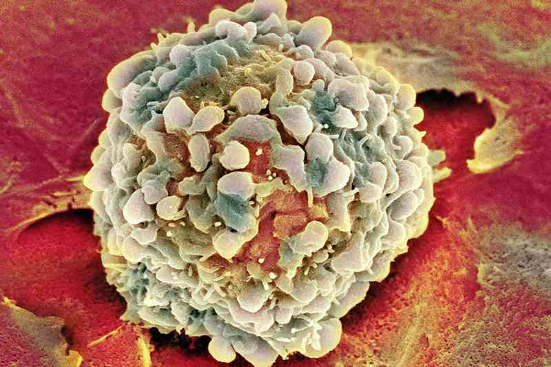胎盘间充质干细胞要不要存