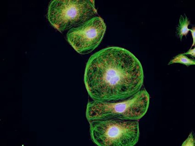 植物干细胞