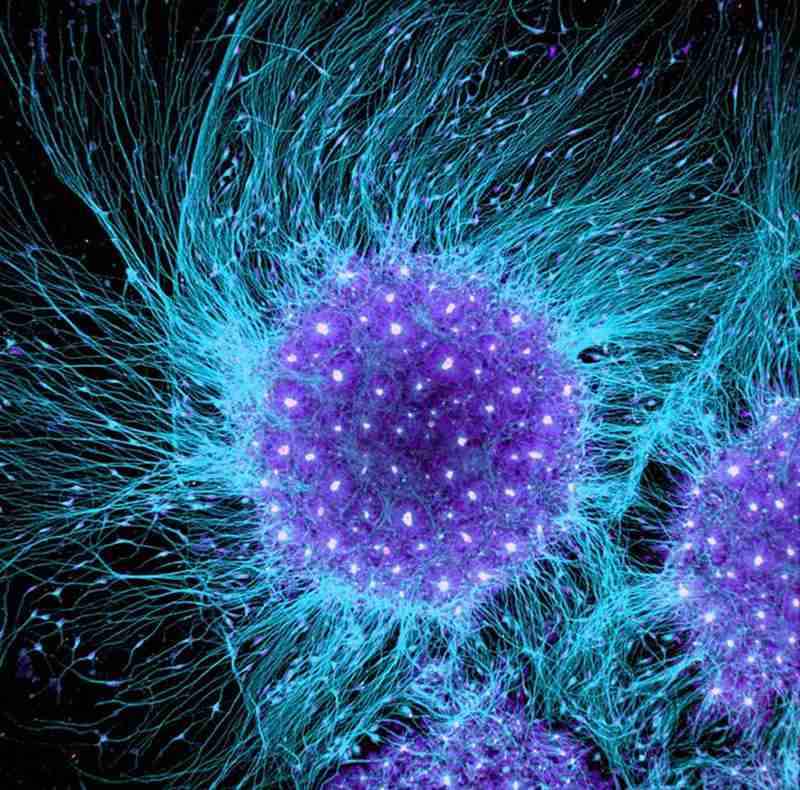 干细胞技术抗衰老更值得期待！