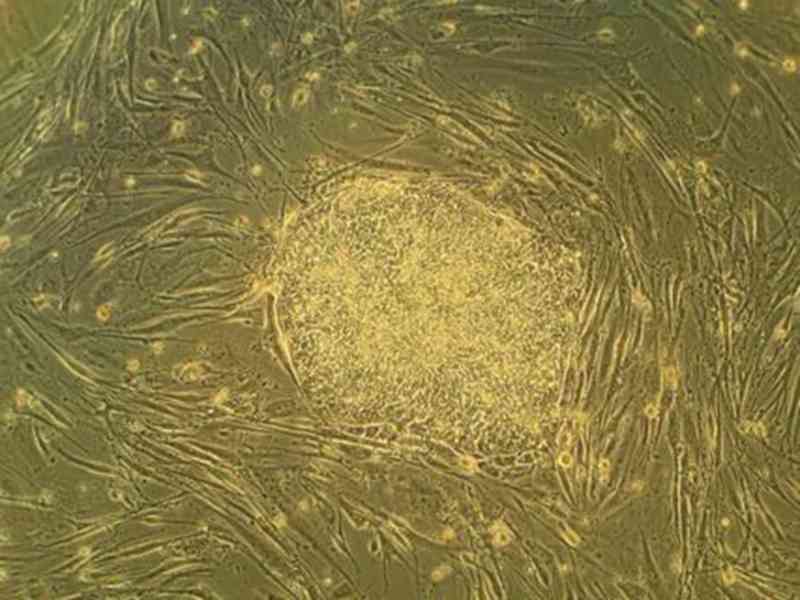 干细胞能做美容吗