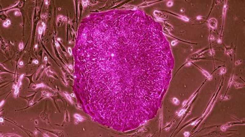 生殖干细胞抗衰老的特性