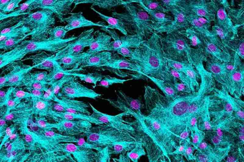 间充质外泌体干细胞的美容效果如何